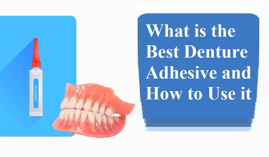 What is the Best Denture Adhesive and How to Use it